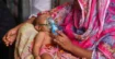 হাম উপসর্গে আরও ৭ শিশুর মৃত্যু