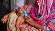হাম উপসর্গে আরও ৭ শিশুর মৃত্যু
